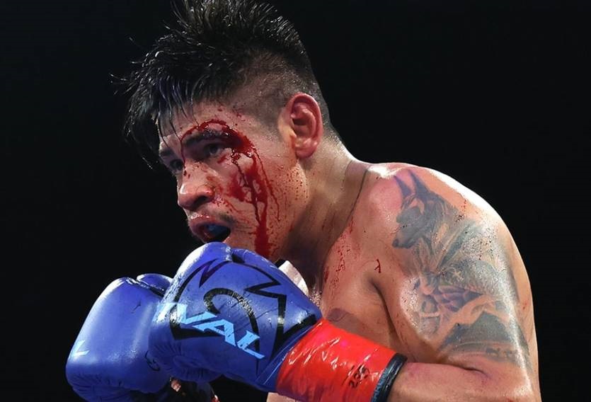 Новини спорту - Наваррет пролив світло на суперечливий момент зупинки його бою з Суаресом