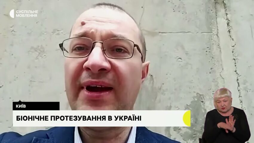 Біонічне протезування. Гостьова студія з Віталієм Музиченко, гендиректором Фонду.