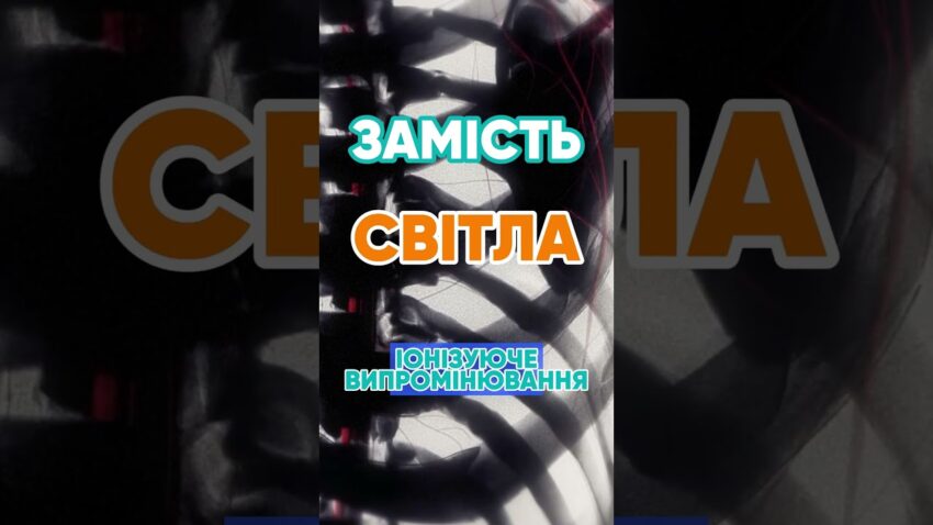 Чому рентген показує кістки? 🦴 #наука #цікаво #рентген #медицина